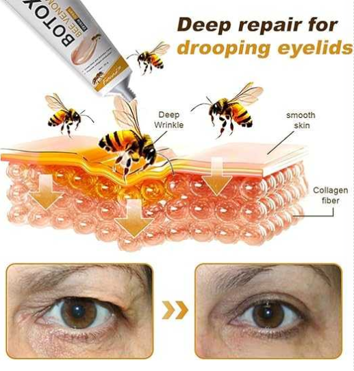 Botox Bee Venom Cream
